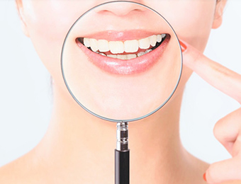 前歯の気になる部分だけ治療ができる部分矯正