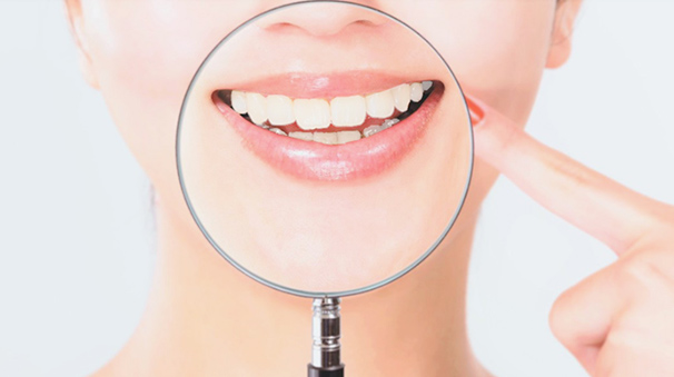 前歯の気になる部分だけ治療ができる部分矯正