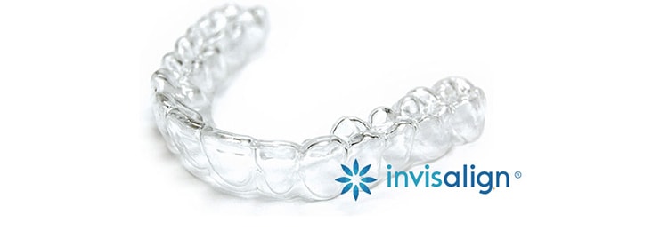 マウスピース型矯正装置～インビザライン invisalign～